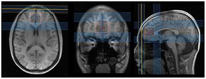 Lower Ventromedial Prefrontal Cortex Glutamate Levels in Patients With Obsessive–Compulsive Disorder